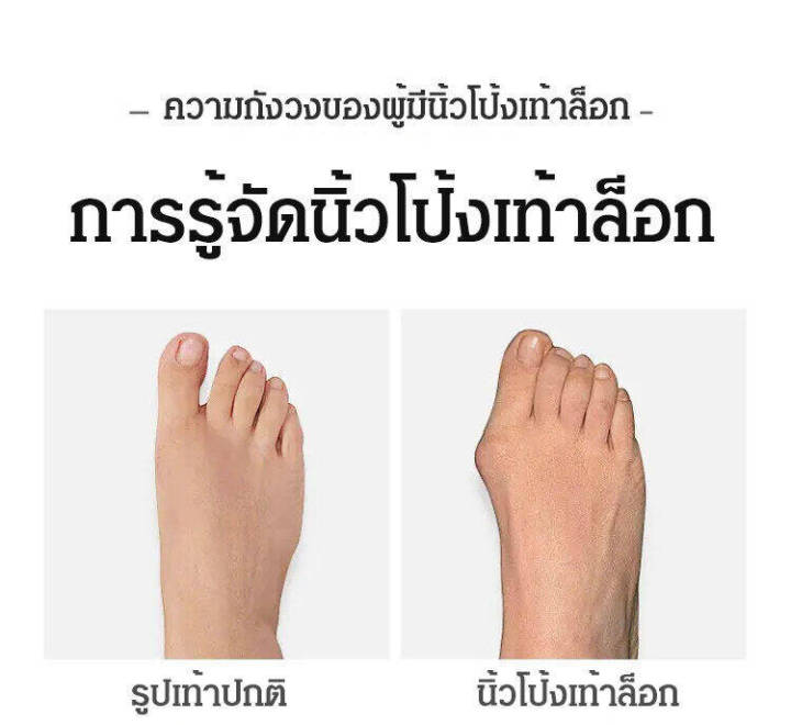 นำเข้าจากประเทศเยอรมนี-อุปกรณ์ดัดนิ้วเท้า-อุปกรณ์แก้ไขเท้าผิดรูป-ซิลิโคนคั่นนิ้วเท้า-อุปกรณ์คั่นนิ้วเท้า-อุปกรณ์แก้ไขเท้า-นิ้วโป้งโค้งงอเข้