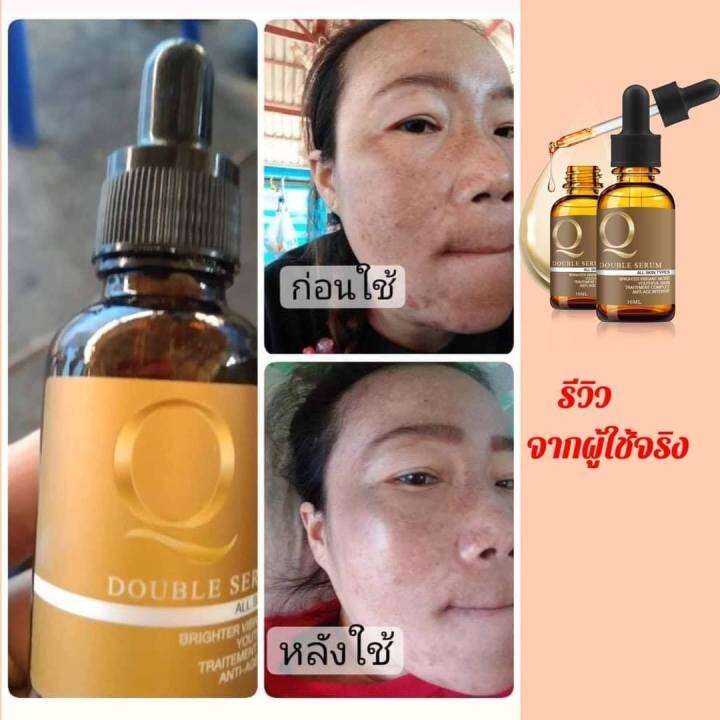 แพ็ค-1-ขวด-q-double-serum-เซรั่มคิว-ขนาด-30-ml-จำนวน-1-กล่อง-ของแท้