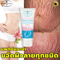 เน้นการดูแลและซ่อมแซมหลังคลอด Aichun Beauty ครีมทารอยแตกลาย ลดรอยแตกลาย ให้ความชุ่มชื่นแก่ผิว เพิ่มความยืดหยุ่นและซ่อมแซมผิวหลังคลอด（ครีมลดรอยแตก/ครีมทาขาแตกลาย/ลดรอยแตกลาย/ ครีมทาแตกลาย/ครีมทาท้องลาย /ลายท้อง/ครีมหลังคลอด/ครีมแก้ขาลาย/ครีมท้องแตกลาย）