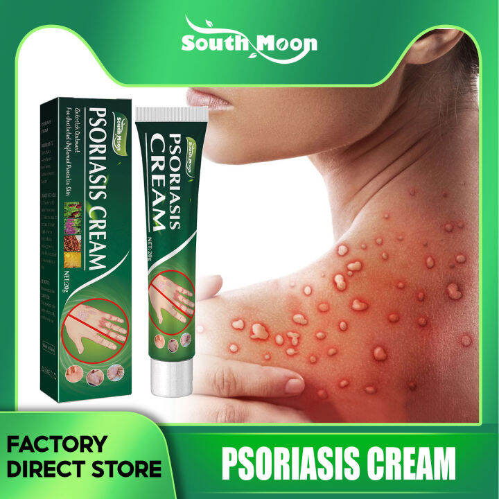 South Moon Psoriasis Cream Antiitch Cream Eczema Ointment Psoriasis