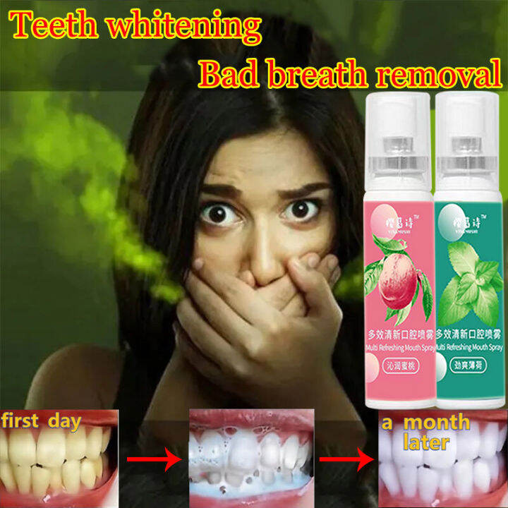 mouth wash mouth freshener spray mouth spray spray 20ml Fresh breath quickly removes bad breath