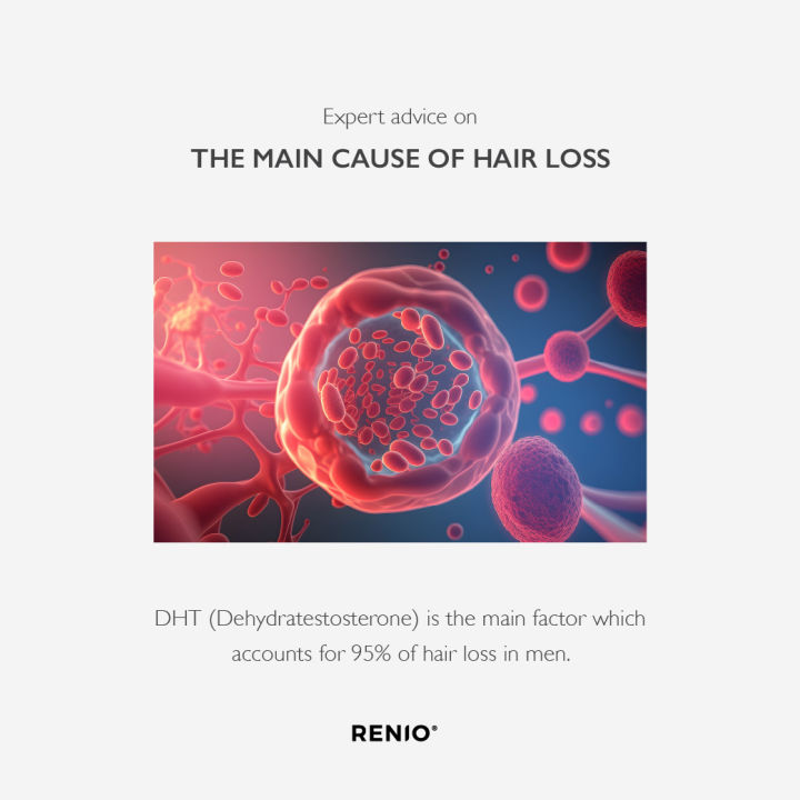 renio-specific-point-serum-for-hair-growth-30ml-เซรั่มปลูกผม-กระตุ้นผมขึ้นใหม่-หยุดผมร่วง-ผมบาง-หัวล้าน