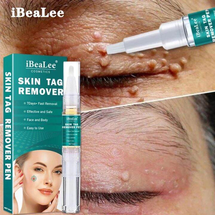 IBeaLee original wart remover, wart remover, flat wart, especially