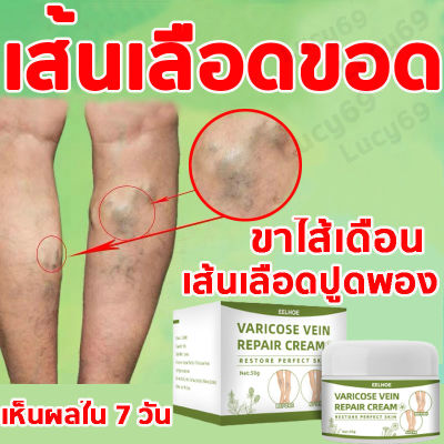 EELHOE Venous Repair Cream Massage for Legs to Relieve Pain, Dredge Meridian and Vein Relaxation Care Repair Cream 50g Buy 3 Get 1 Free