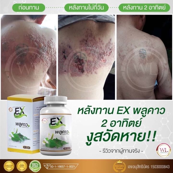 exพลูคาว-2-แถม-4-อาหารเสริมผู้สูงอายุ-บำรุงสุขภาพ-ลดภูมิแพ้-หอบหืด-hiv-พลูคาวบุ๋มปนัดดา-พลูคาวสกัดแคปซูล-ขนาด-30-แคปซูล