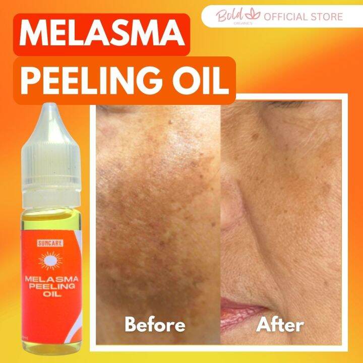 BOLD ORGANIC SUNCARE MELASMA PEELING OIL 10ML AntiMelasma Original