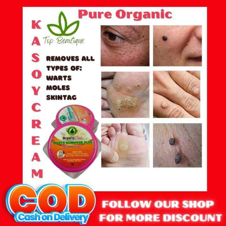 ⚡⭐ 5g KASOY CREAM BRYELS CARE BRYELS ENTERPRISES KASOY CREAM Mole