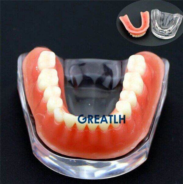 overdenture-implant-model-denture-teeth-mandibular-model-with-golden-bar-dental-teaching-model