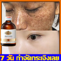 DSIUAN ครีมทาฝ้า 100 ml จางลงฝ้ากระที่หนักได้ ลดเม็ดสีเมลานิน กำจัดฝ้า จุดด่างดำ ฝ้า กระ กระจ่างใสผิว ไม่เหนียวเหนอะหนะ ซึมซับดี （ ครีมทาฝ้ากระ ครีมทาฝ้าหนาๆ ครีมทาแก้ฝ้า ครีม ครีมฝ้ากระ ครีมกำจัดฝ้ากะ เซรั่มทาฝ้า ）