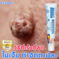 [เตรียมการจัดส่งสินค้า] ป้องกันการเกิดซ้ำy EELHOE  ยาทาหูด ช่วยให้หูดหรือตาปลาหลุดออก หูดตาปลา/ลอกหูดตาปลา/แคลลัสและรากหนาม/หูดและติ่ง ทาแล้วหายได้ทันท ปลอดภัยและไม่เจ็บปวด ใช้ง่าย ฟื้นบำรุงผิวให้เนียนนุ่ม Safe Removal ยาทาหูดตาปลา wart removal