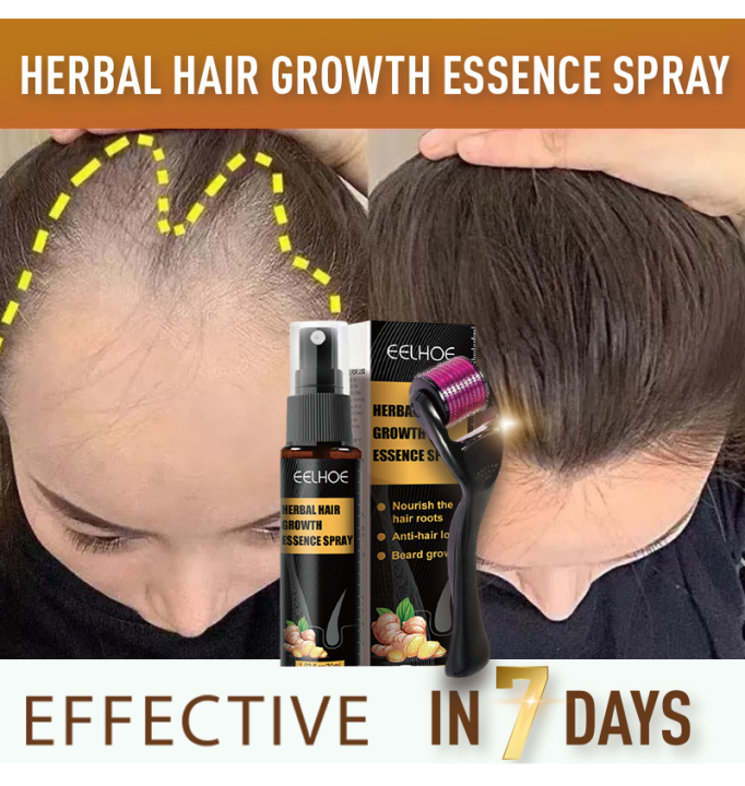 30ml Herbal Hair Growth Essence Spray Set Anti Hair Loss Treatment Hair Regrowth Serum Prevent 4410