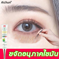 Aichun เซรั่มทาถุงใต้ตา เม็ดไขมัน 30ml ไปถุงใต้ตาและริ้วรอย เพิ่มความชุ่มชื้นและให้ความชุ่มชื่น(อายครีม เม็ดไขมัน ครีมไต้ตา ค