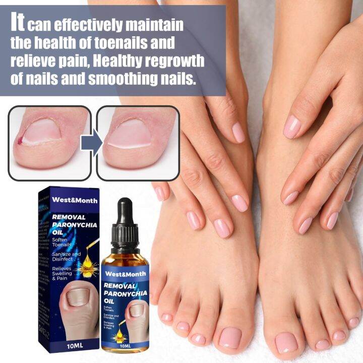CBT 210ml New Useful Nail Repair Toenail Treatment Ingrown Toenails