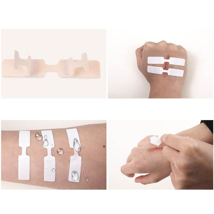 10pcs-new-type-stitch-free-band-aids-outdoor-fast-wound-sutures-zippered-tapes-reduce-posting-outdoor-survival-accessories