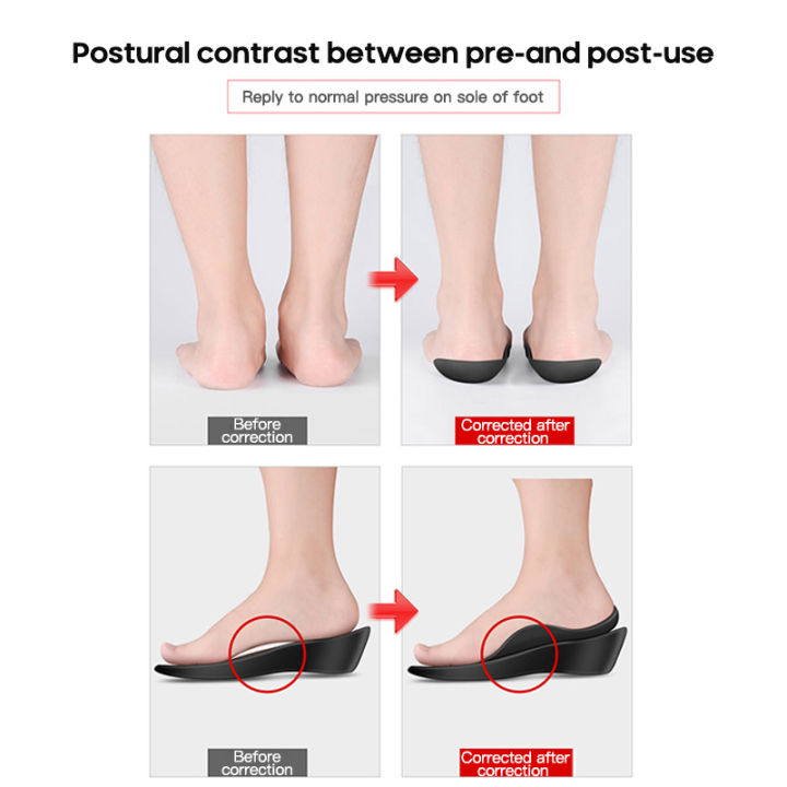 รองเท้าพยุงเท้าแบบแบนสำหรับทั้งชายและหญิง-พื้นรองเท้าขนาดใหญ่สำหรับวางเท้าแบนขารูปตัวโอรองรับความโค้งแผ่นรองฝ่าเท้าอุปกรณ์เสริมสำหรับฝึกหัด