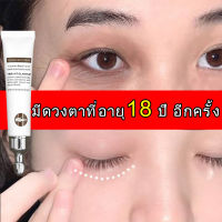 【ซื้อ2แถม1】ครีมบำรุงใต้ตา อายครีม ครีมลดขอบตาดำ ครีมลดถุงใต้ตา แบ่งเบาริ้วรอย ดูแลรอบดวงตา ครีมทารอบดวงตา Eye cream