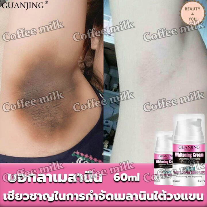 ลดเมลานินผิว-guanjing-ครีมทารักแร้ขาว-60ml-ครีมขาขาว-ครีมกำจัดเมลานิน-อ่อนโยนไม่ระคายเคือง-ครีมทาใต้วงแขน-ขจัดผิวคล้ำของใต้วงแขน-ไวท์เทนนิ่งครีม-ครีมบำรุงช่วยให้ผิวใต้วง-ครีมทาขาหนีบดำ-ปรับสีผิวให้กระ