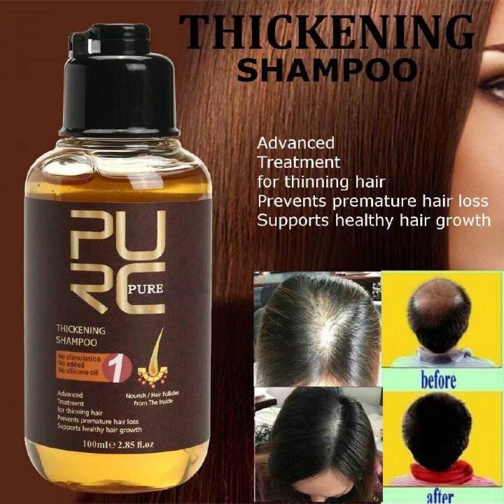 Purc Hair Growth Serum Fast Hair Growth Spray Hair And Scalp Treatments Anti Hair Loss Lazada Ph 9509