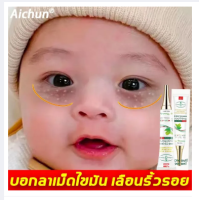 Aichun เซรั่มทาถุงใต้ตา 30ML อายครีม เม็ดไขมัน ครีมไต้ตา ครีมทาใต้ตดำ าบำรุงสายตา ครีมทาตาดำ ครีมทารอบดวงตา รอยตีนกา