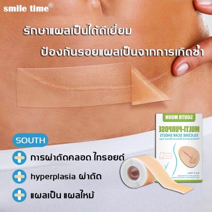 จัดส่งทุกวัน South Moon รักษารอยแผลเป็น แผ่นแปะแผลเป็น 4cm 150cm กําจัดรอยแผลเป็นจากแผลเป็น