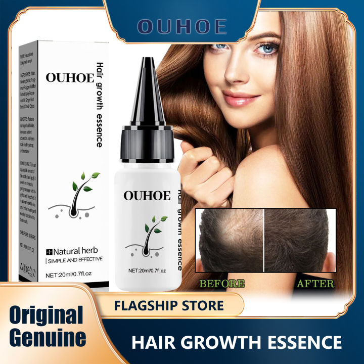 Ouhoe Hair Growth Essence Moisturizing Hair Streng Thening Hair Growth ...