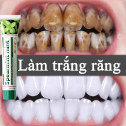 Bột Đánh Răng Làm Trắng Răng kem đánh răng trắng răng và hôi miệng 100g