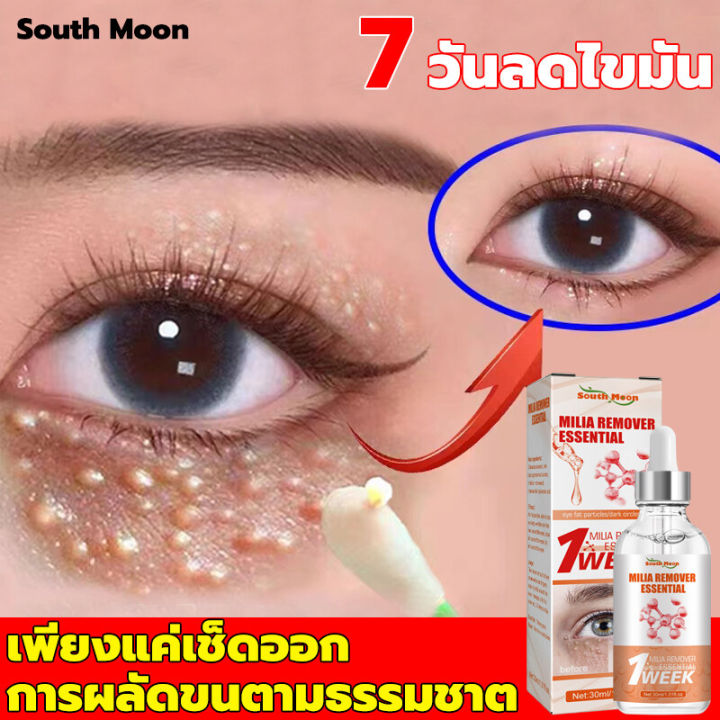 เห็นผลชัดเจน-south-moon-ครีมบำรุงรอบตา-30ml-ลดริ้วรอยรอบดวงตา-ลดถุงใต้ตา-ครีมบำรุงใต้ตา-ยกกระชับ-เม็ดไขมัน-ครีมทาตาเม็ดไขมัน-ครีมทาใต้ตาดำ-ครีมกำจัดถุงใต้ตา-อายครีม-อายครีมริ้วรอย-ครีมบำรุงรอบดวงตา-คร