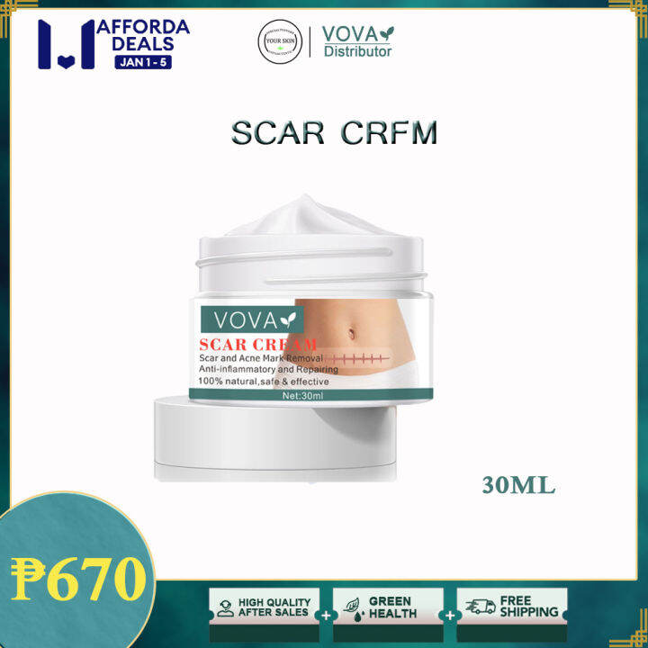 1.1Anniversary Sale YOUR SKiN& VOVA ACNE FACE CREAM Lazada PH