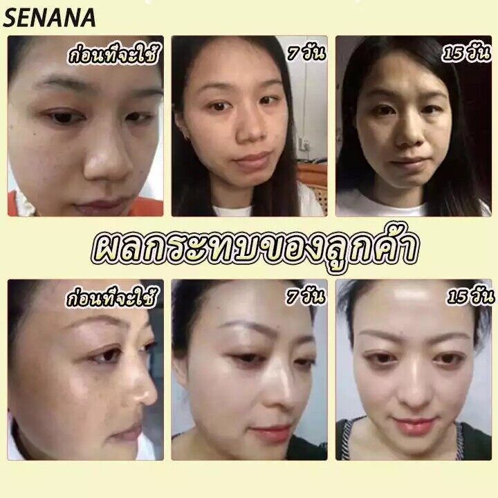 ครีมบำรุงหน้า-ครีมหน้าขาวใส-ครีมทาฝ้า-ครีมทาหน้าขาว-ครีมรักษาฝ้า-ครีมทาฝ้าหนาๆ