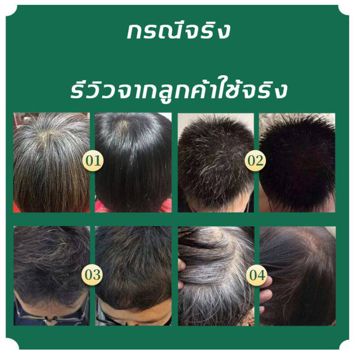 แชมพูสระผม-tgk-แชมพูปิดผมหงอก-แชมพูแก้ผมหงอก-แชมพูเหอโส่วอู-300ml-แชมภูปิดผมขาว-แก้ผมหงอกถาวร-แชมพูปิดหงอก-ผมหงอกกลับมาดำ-แก้ผมหงอก-แชมพูสมุนไพร-น้ำยาแก้ผมหงอก-แชมพูผมดกดำ-แชมพูขิง-แชมพูปิดผมขาว-เซรั่