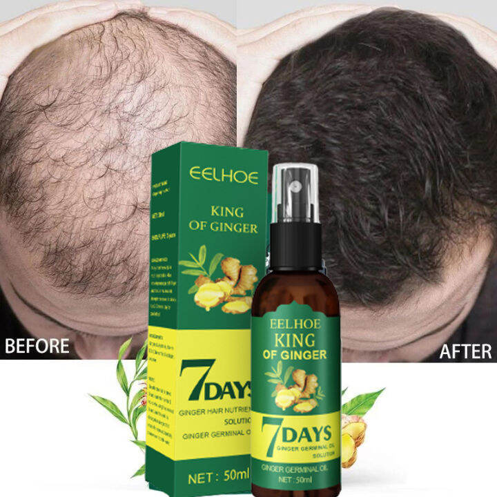 7days Fast Hair Growth 50ml Hair Growth Serum Hair Grower Fast Long