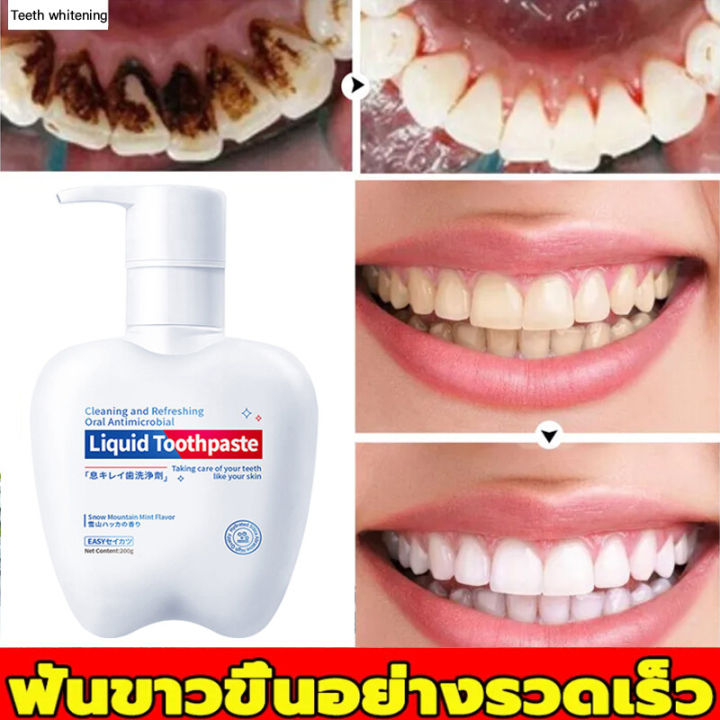 ฟันเหลือง-ขาวสดใสขึ้น-10-เท่า-นำเข้าจากญี่ปุ่น-ยาสีฟันฟอกฟันขาว-95-โปรไบโอติกที่ใช้งานสูง-ฟันเหลือง-ฟันดำ-ฟันบุหรี่-ยิ่งแปรงยิ่งขาว-ไม่ทำลายเคลือบฟัน-ใช้-1-ครั้ง-ยาสีฟันฟันขาว-ป้องกันฟันผุ-ทพความสเอาด