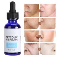 jt2204785jiao Glycolic Acid Peel Purity 70 Concentration 5 Skin Repair Invisible Pores Brighten Skin Tone Treat Acne Mild And Non-Irritating