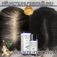 เซรั่มปลูกผม 20ml BREYLEE น้ำยาปลูกผม บำรุงรากผม บอกลาหัวล้าน.เหมาะกับทุกปัญหาผมร่วง ผมบาง.นีโอแฮร์ของแท้ เซรั่มผมร่วง.ทรีนเมนบำรุงผม เร่งผมยาวไว ป้องกันผมร่วงอย่างมืออาชีพ (บำรุงผม ลดผมร่วง แก้ปัญหาผมร่วง เซรั่มบำรุงผม)