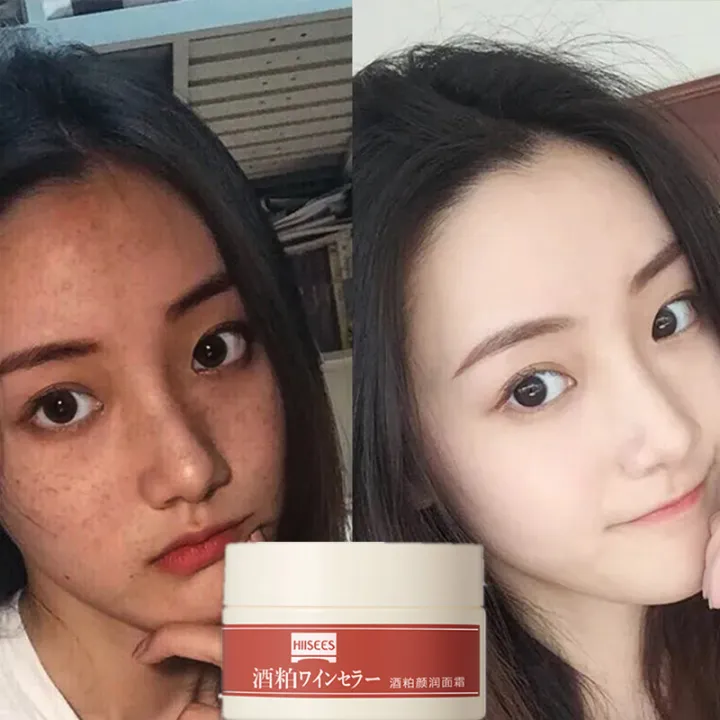 Facial Mask Face Whitening Clay Mask For Face Collagen Mask Whitening