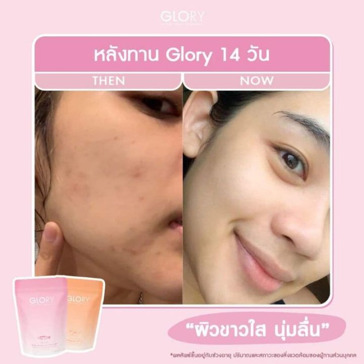 กลอรี่-glorycollagenของแท้-tomato-vit-c-กลอรี่คอลลาเจนไดเปปไทด์-โทเมโท่วิตามินซี-กลอรี่คอลลาเจนของแท้-พร้อมส่ง