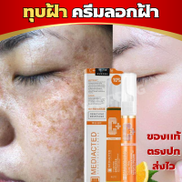 ครีมแก้ ฝ้า กระ ครีมแก้ฝ้าถาวร vitamin c ครีมทาฝ้าหนาๆ ครีมทาฝ้า ครีมลอกฝ้า ครีมฝ้ากระลึก ครีมหน้าขาวใส ครีมลอกฝ้าหนา ครีมทาฝ้าเลือดฝ้าแด