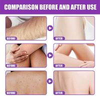 ZZOOI Effective Hair Removal Scrub Hair Growth Inhibitor Painless Exfoliating Cream Deep Cleansing Acne Whitening Nourishing Body Care