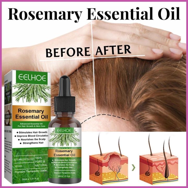 hair-growth-serum-30ml-rosemary-for-loss-treatment-longer-thicker-wsdph