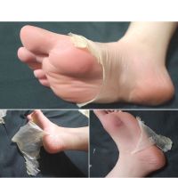 1Pair Dead Skin Remover Feet Exfoliating Heels Foot Pedicure Peeling Feet Description