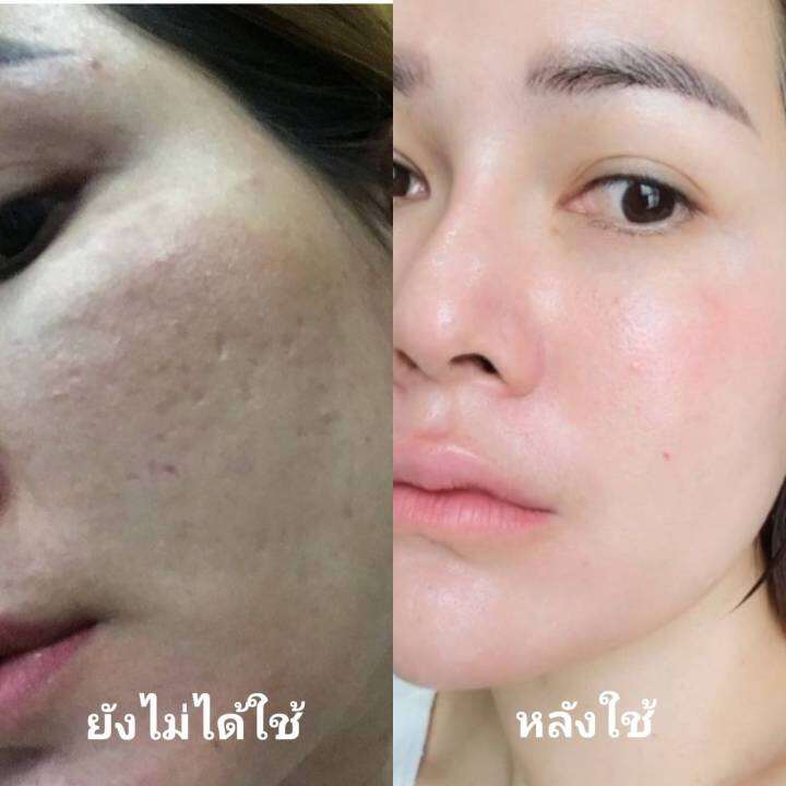 psc-สบู่หน้าเงา-aura-soap-1ก้อน-ขนาด-70g-princess-skin-care