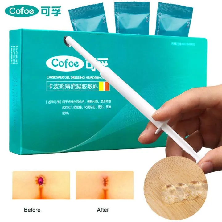 【Free Alcohol Swabs】Cofoe 3pcs Carbomer Hemorrhoid Ointment Cream Exteral Hemorrhoid Transparent Gel with Applicator