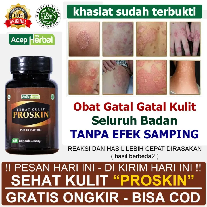 Obat Gatal Gatal Kulit Seluruh Badan Gatal Jamur Selangkangan Kurap