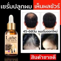 ?สินค้าขายดี? SERUM น้ำยาปลูกผม ยาปลูกคิ้ว ยาปลูกหนวด ยาปลูกผม หัวเถิกปลูกผม ทำให้ผมหนา X1ขวด