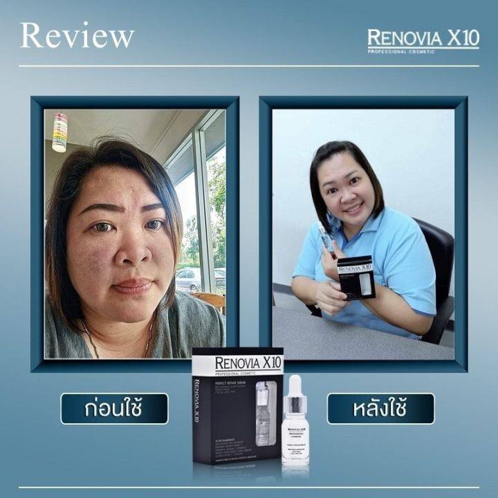 ตรงปก-จบปัญหาผิวหน้า-ของแท้-renovia-x10-professional-cosmetic-ฺั-by-18-อีกครั้ง