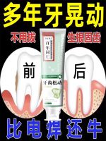 High efficiency Japan original Li Shizhen Dental Separator Special Toothpaste for Loose Teeth Gum Recession Restoration Regeneration Tooth Root Exposure Solid Teeth