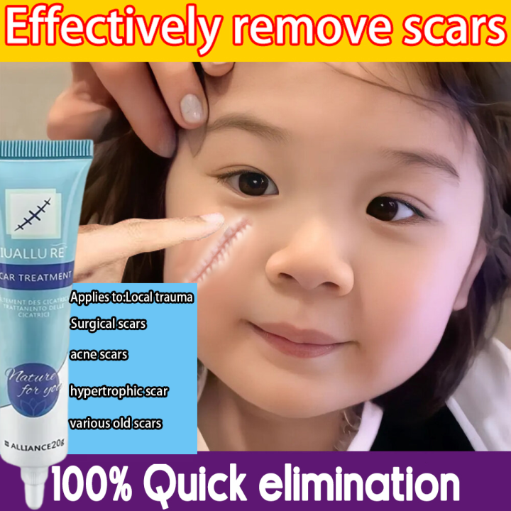 Scar Repair Gel Scars Treatment Gel Scar removal 20g Skin Mark Care