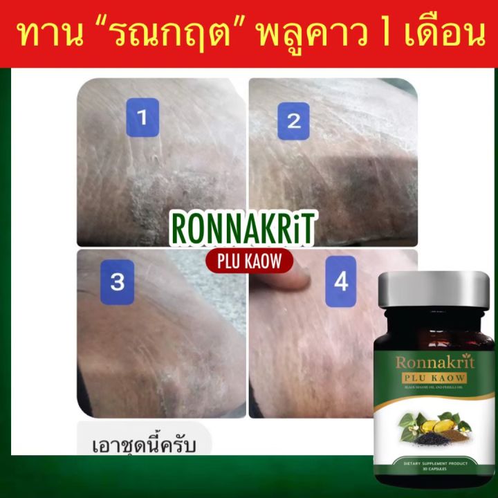 ส่งฟรี-พร้อมส่ง-สะเก็ดเงิน-กลากเกลื้อน-เชื้อรา-สมุนไพรพลูคาว-รณกฤต-อาหารเสริมสมนไพร-พลูคาวสกัด-ภูมิคุ้มกัน-ร่างกายสมดุล