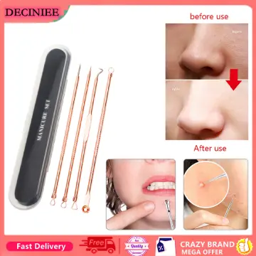 4PCS Stainless Steel Blackhead Acne Remover Needle Tool Blackhead Remover  Dark Sore Acne Extractor Clean Beauty