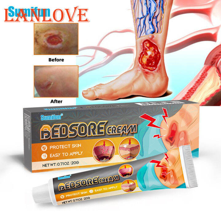 LANLOVE Repair Pressure Ulcers Cream Rotten Leg Bedsore Wound Care